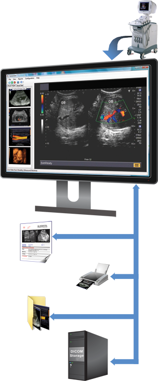 Ultrasound Imaging Workstation Software