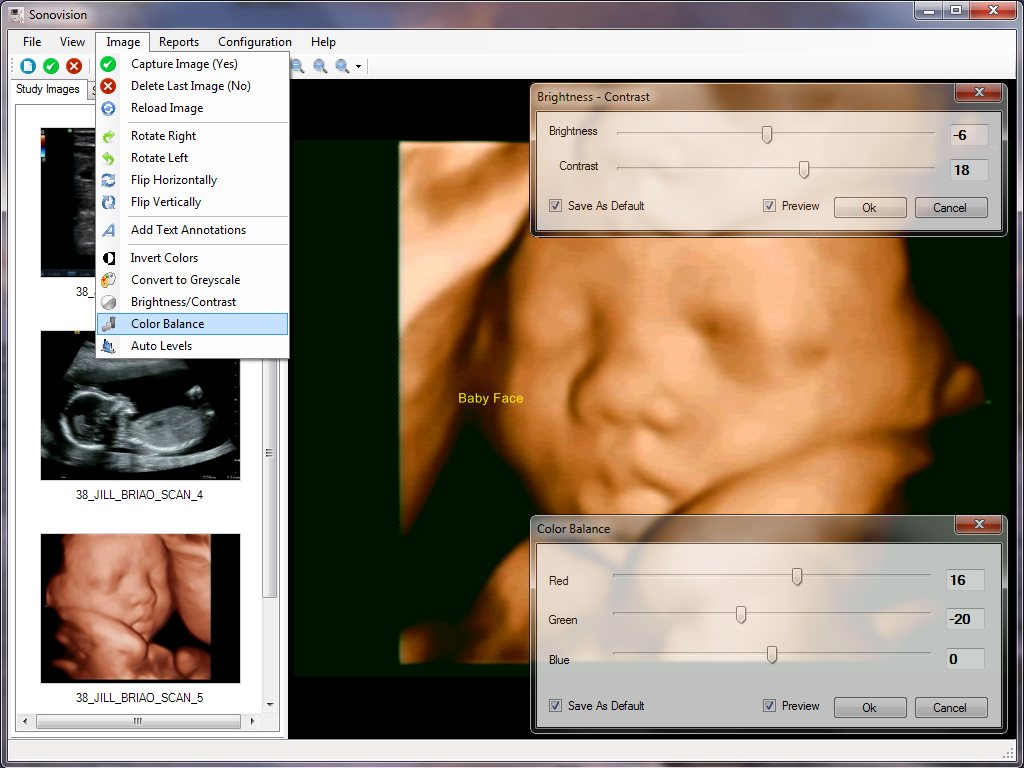 Ultrasound Image Enhancements