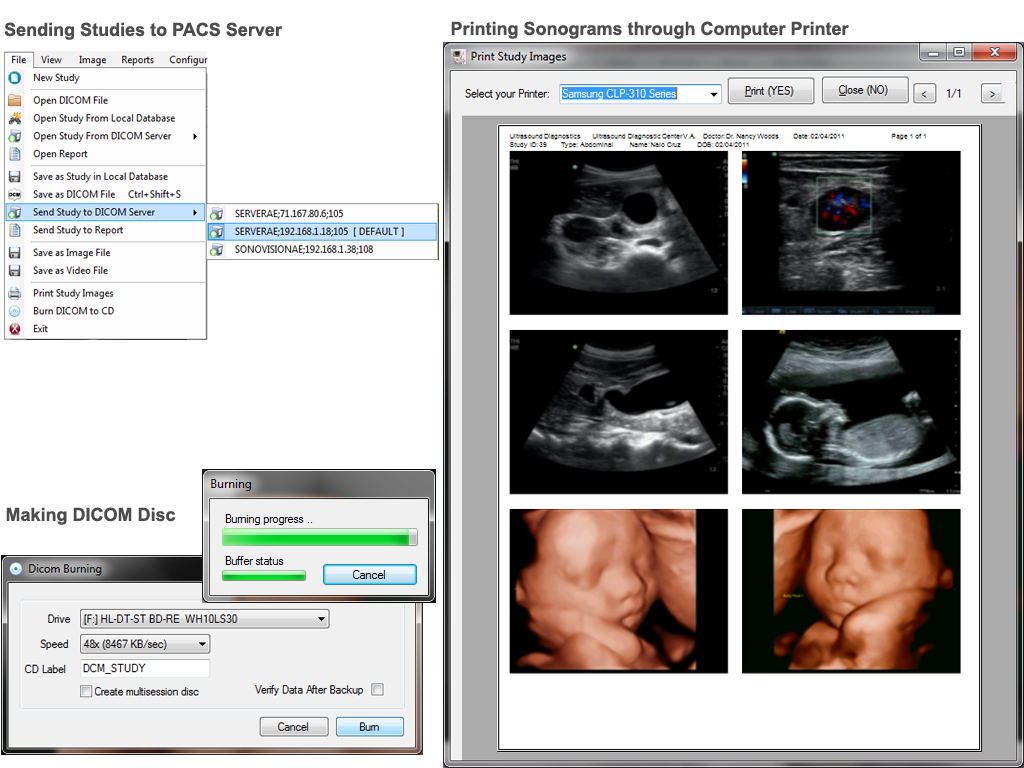 Send Studies to PACS, DICOM CD or Printer