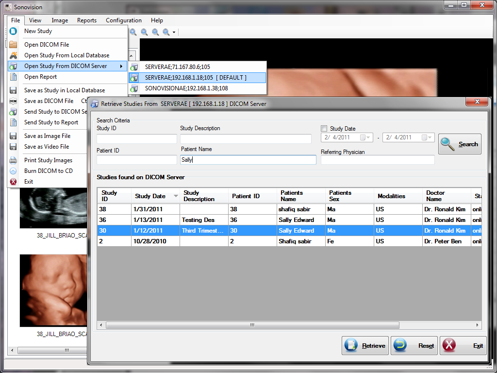 PACS Worklist