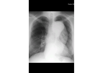 Full Screen Images View