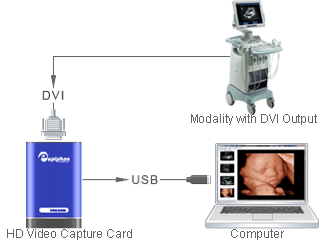 High Definition Video Capture Card for Sonovision 2.0