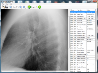 Easy DICOM Viewer for Windows PCs