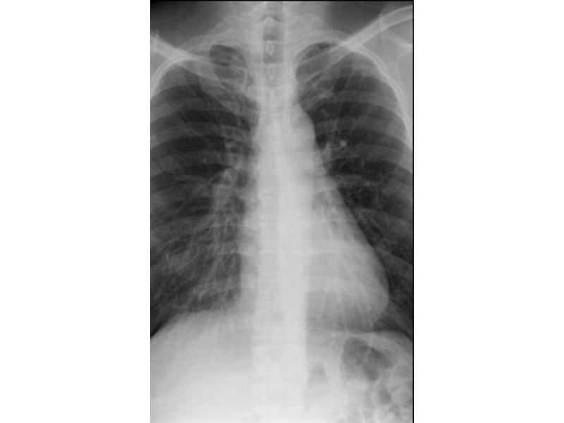Chest X-Ray on Windows Phone 7