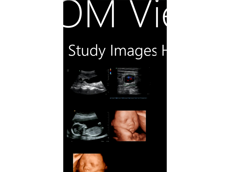 Ultrasound Study on Windows Phone 7