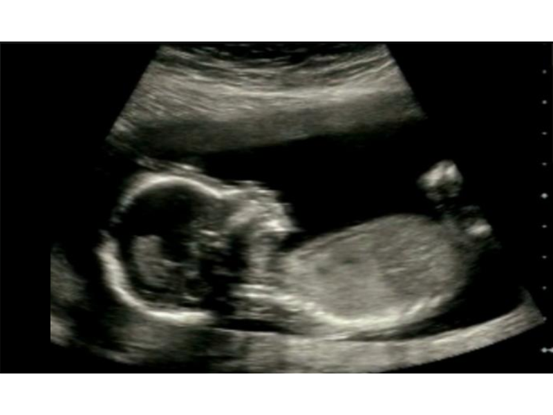 Ultrasound Image on Windows Phone 7 Full Screen Zoom